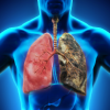 Air pollution impairs function of blood vessels in lungs